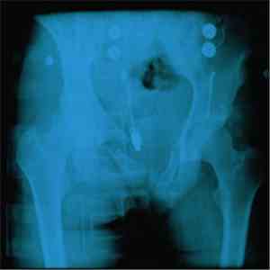 Mature Situations - Cracked Pelvis